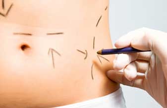 Marcelo Lins Cirurgia Plástica - Foto 1
