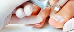 podologia-e-podologos-recife-1397742698