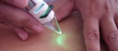terapia-recife-1397748320