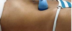 ultra-som-recife-1397748667